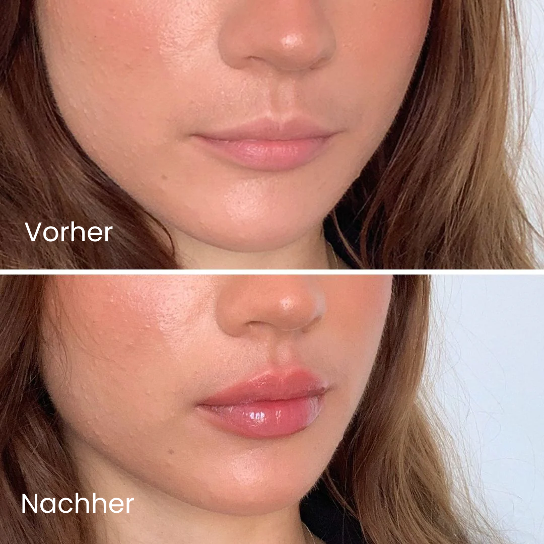 Glossy Lip Plumper